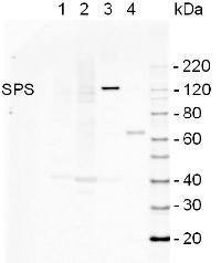 SPS | Sucrose phosphate synthase (maize) in the group Antibodies Plant/Algal  / Carbohydrates at Agrisera AB (Antibodies for research) (AS06 185)